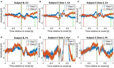 Metric Learning in Freewill EEG Pre-Movement and Movement Intention Classification for Brain Machine Interfaces